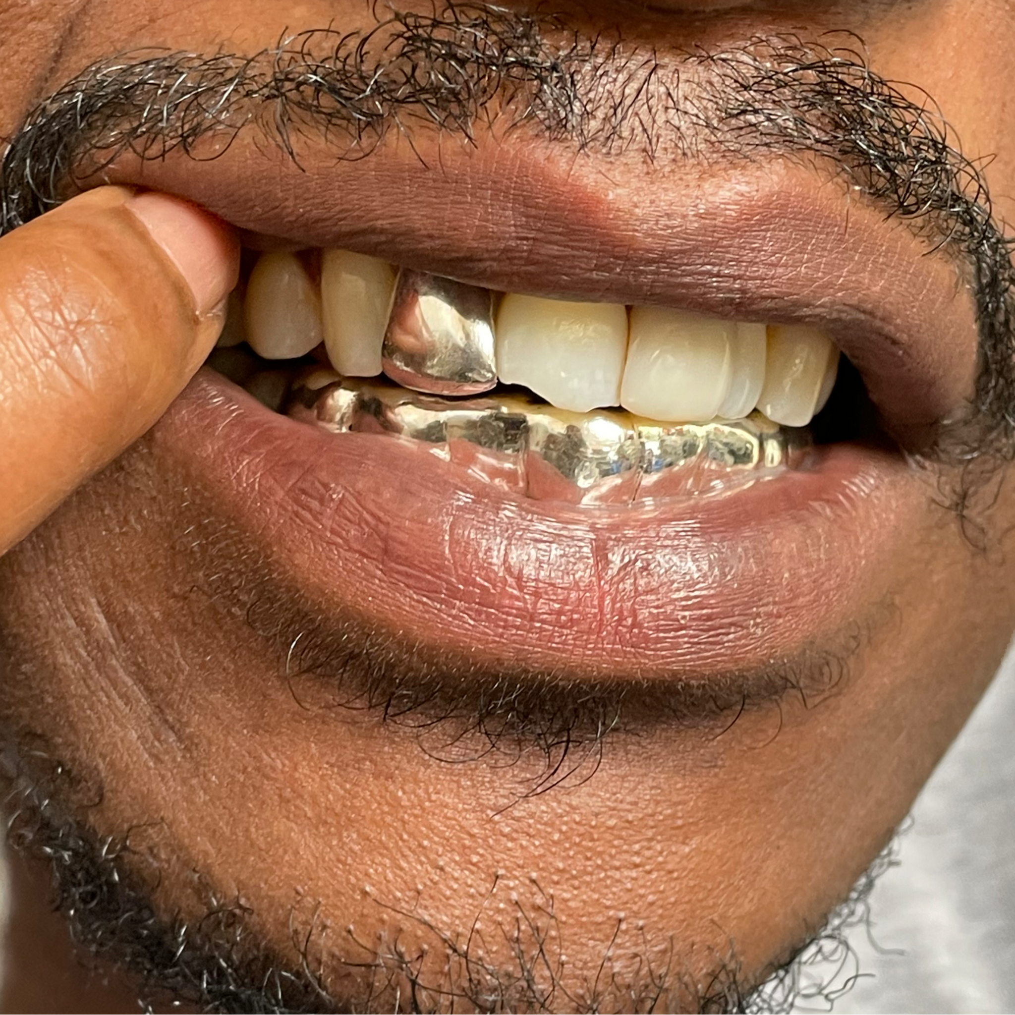 Grillz Single Cap - Sterling Silver